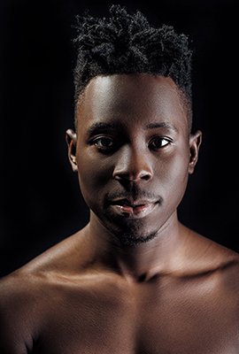 black_man_candidate_for_afro_hair_transplant_in_turkey