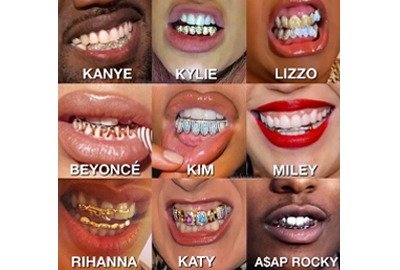 celebrities_showcasing_teeth_after_hollywood_smile_in_turkey