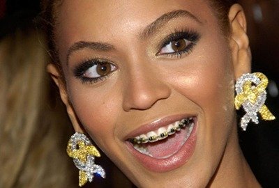 celebrity_with_braces_after_hollywood_smile_in_turkey