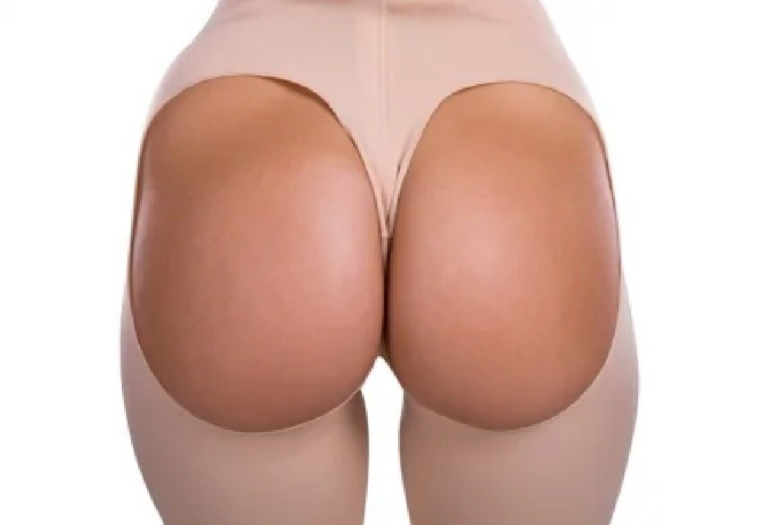 compression_garment_after_hip_dip_correction_in_turkey