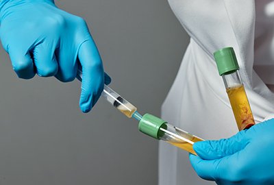 doctor_with_centrifugated_blood_for_erectile_dysfunction_treatment_in_turkey