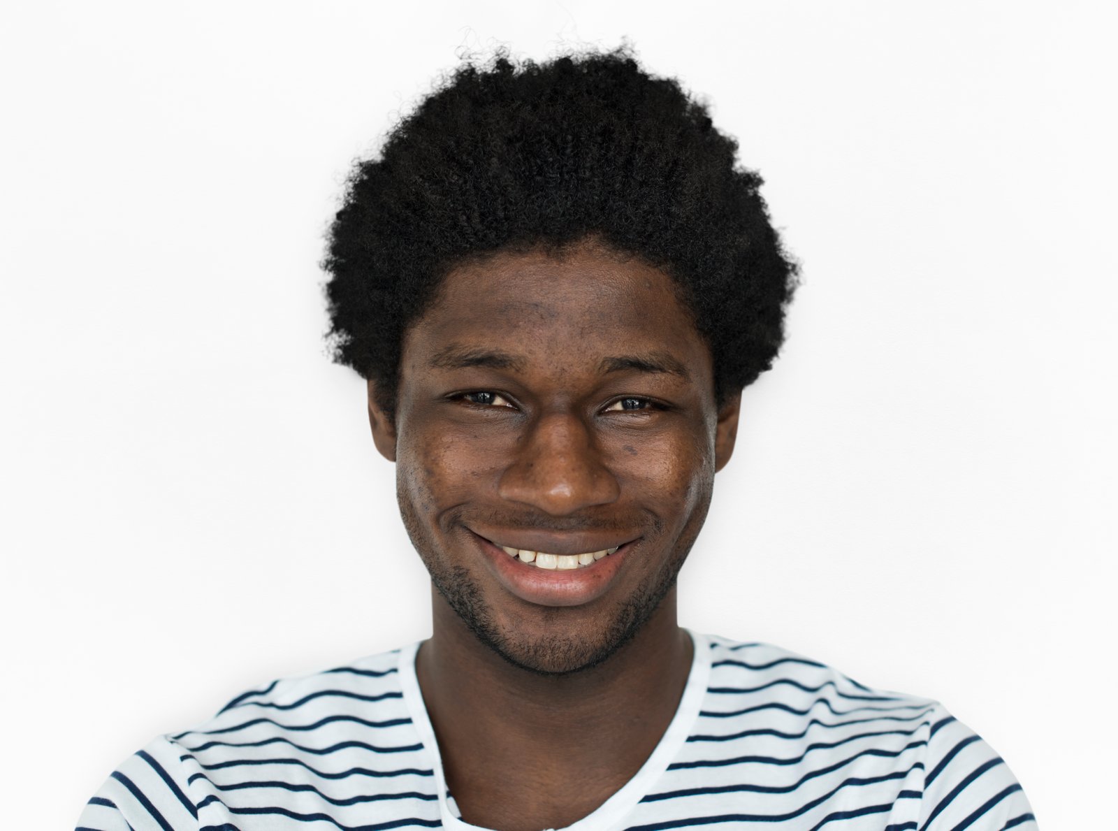 etnik_rinoplasti_cerrahisi