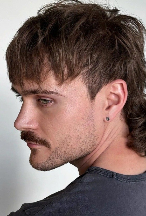 hairstyle_alternative_to_forehead_reduction_in_turkey