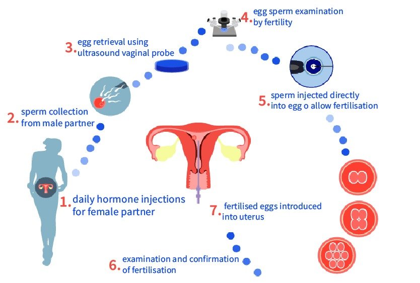 icsi_in_turkey_procedure_again