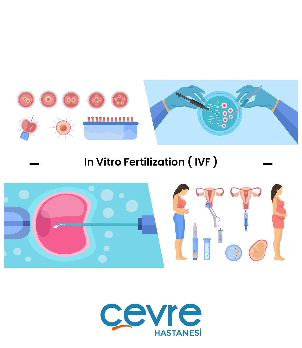 in_vitro_fertilizasyonivf_tedavisi