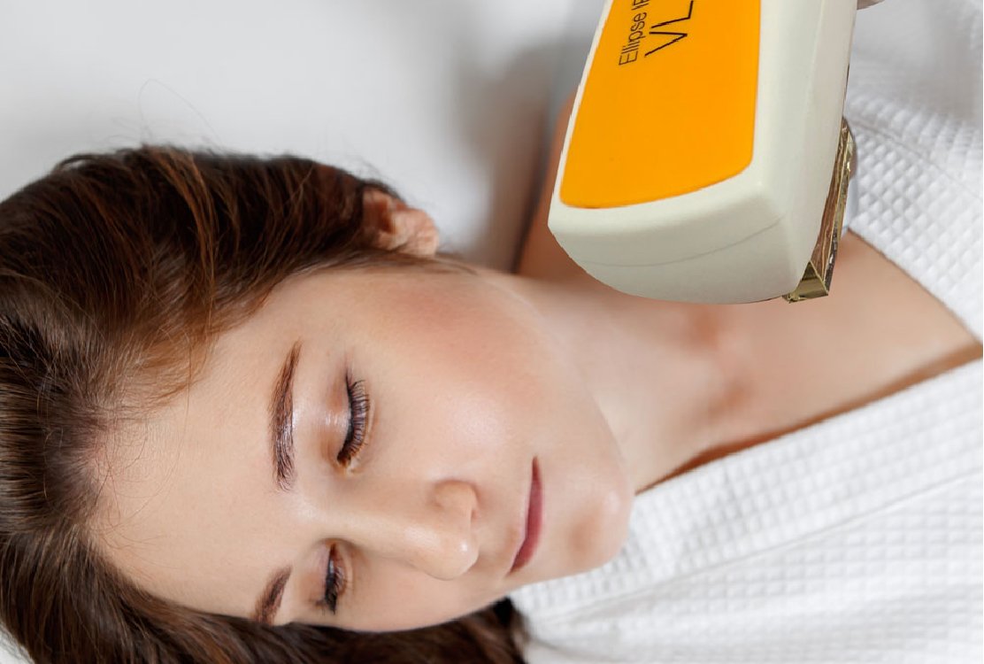 ipl_ for _decolletage _rejuvenation_ in _turkey