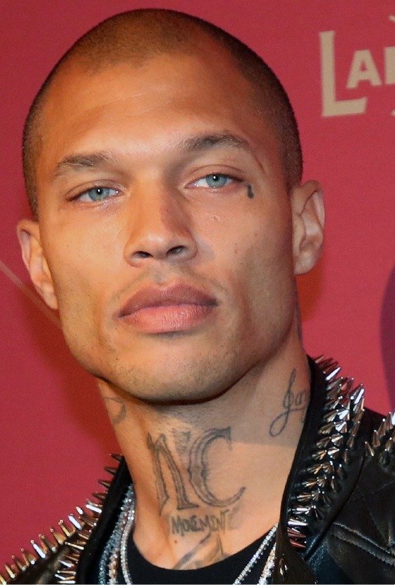 jeremy_meeks_after_lip_lift_in_turkey