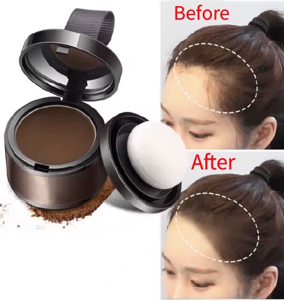 makeup_for_alternative_forehead_reduction_in_turkey