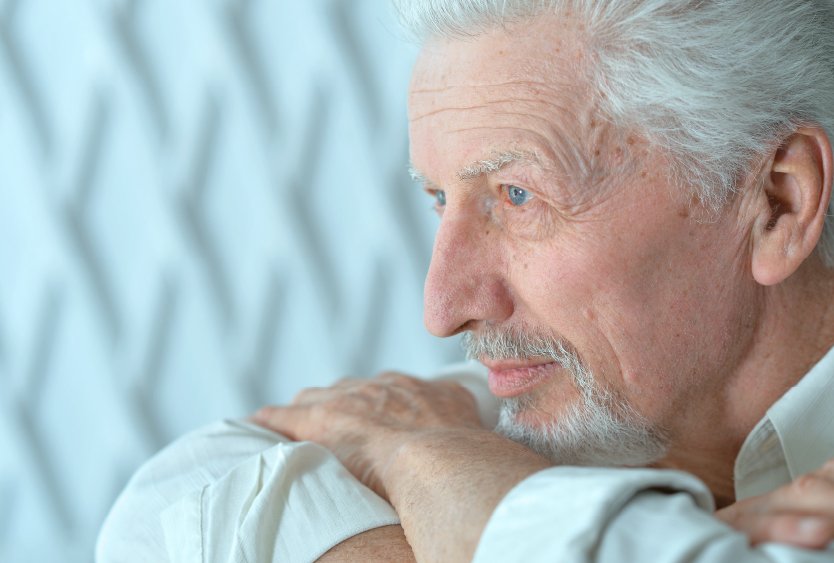 man_after_for_head_reduction_in_turkey_and_old