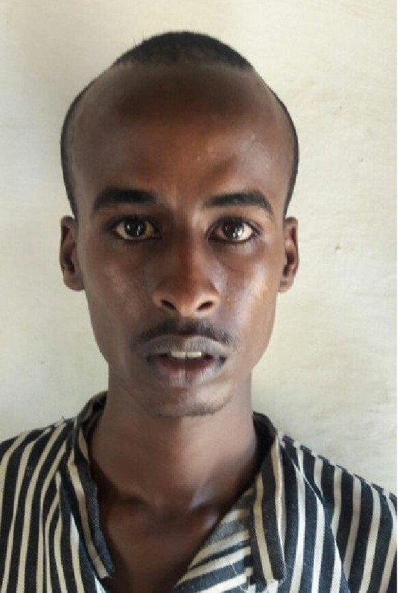 man_before_forhead_reduction_in_turkey