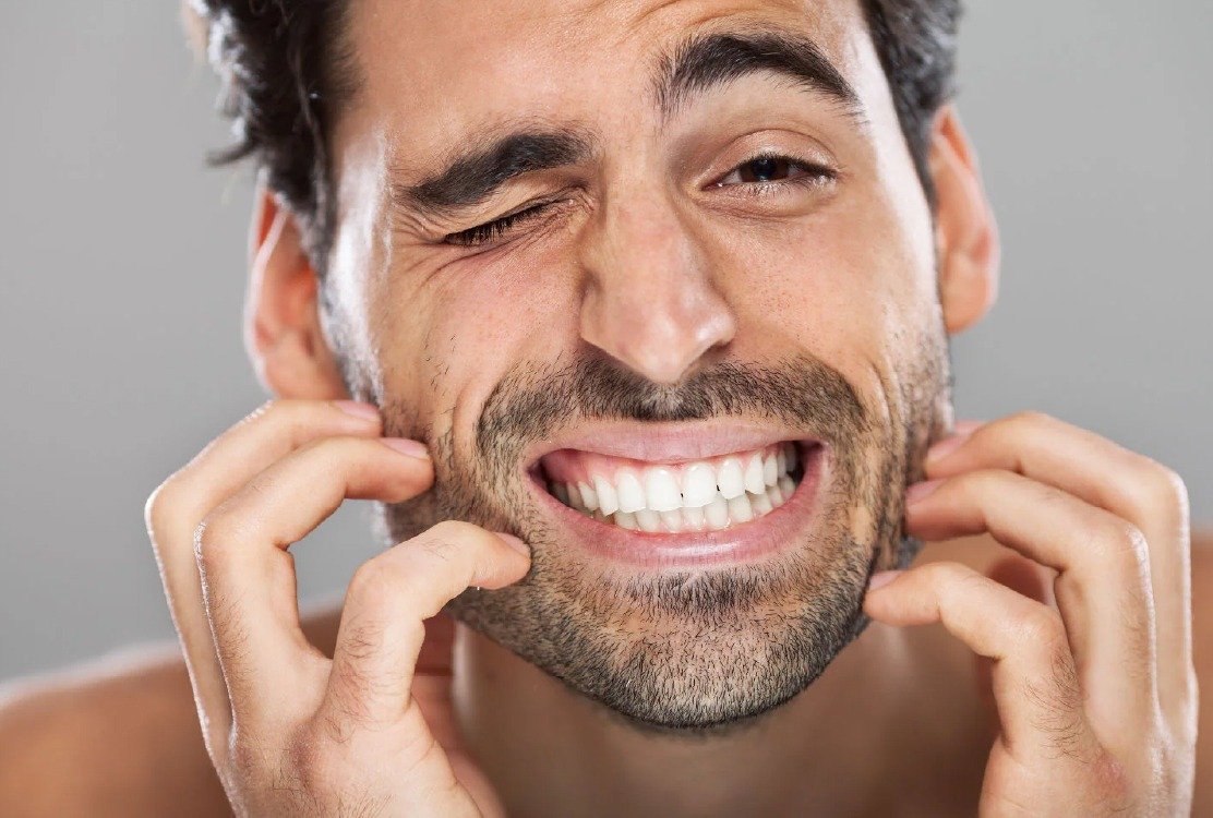 man_with_itchy_face_after_morpheus8_in_turkey