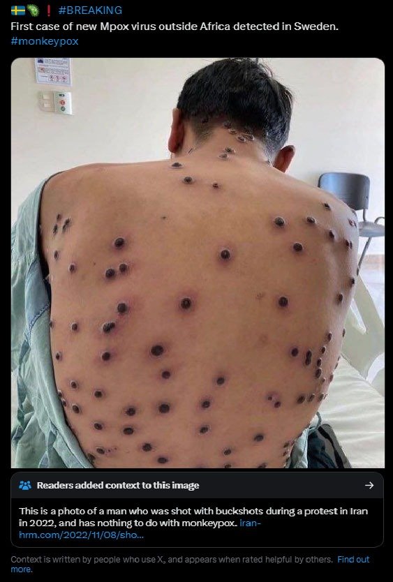 misinformation_regarding_monkeypox_in_turkey