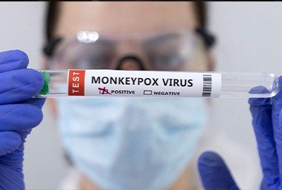 monkeypox_in_turkey_diagnosis
