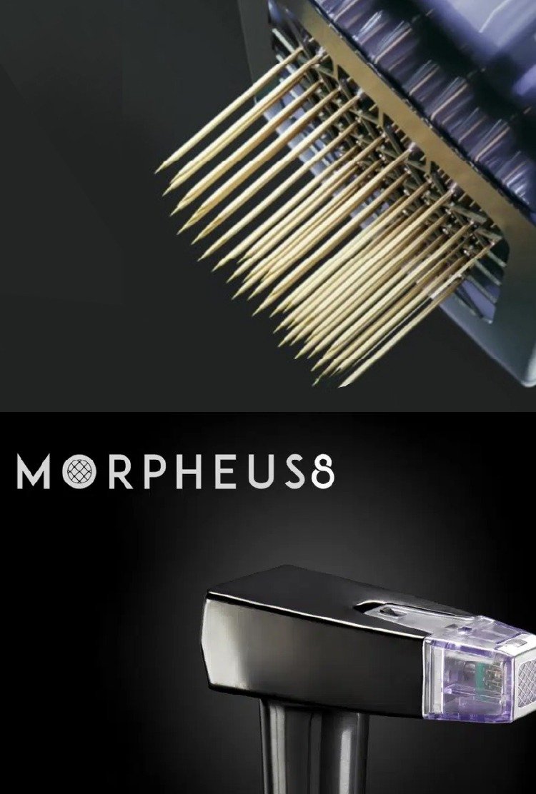 morpheus8_in_turkey_device_pic