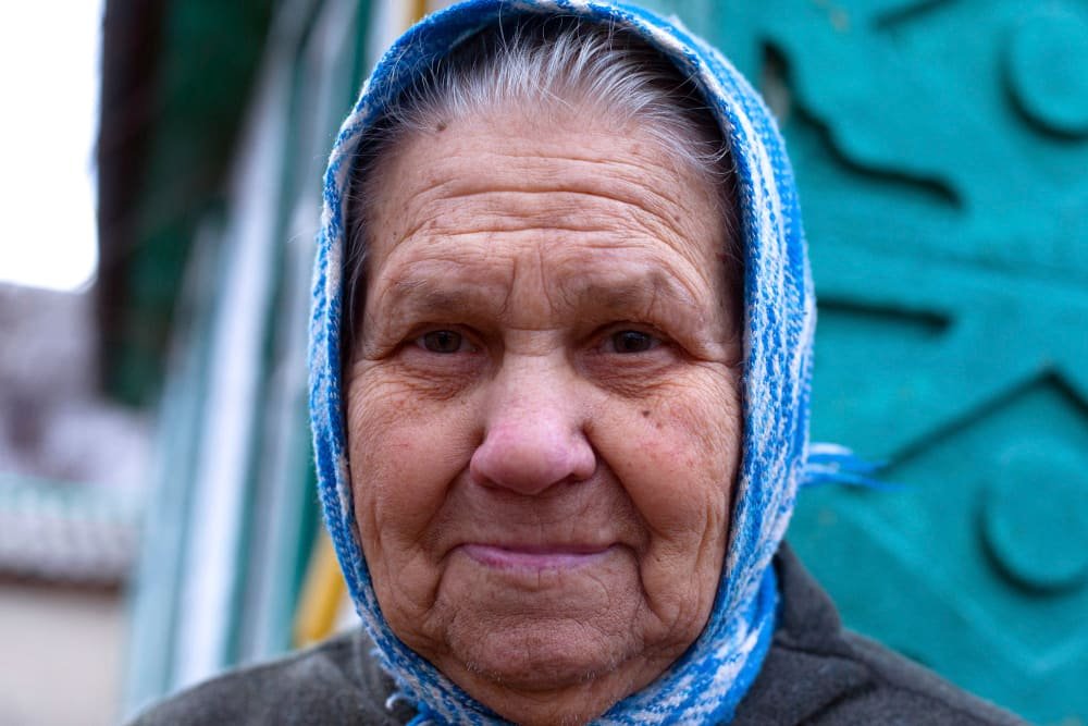 old_woman_candidate_for_tummy_tuck_in_turkey