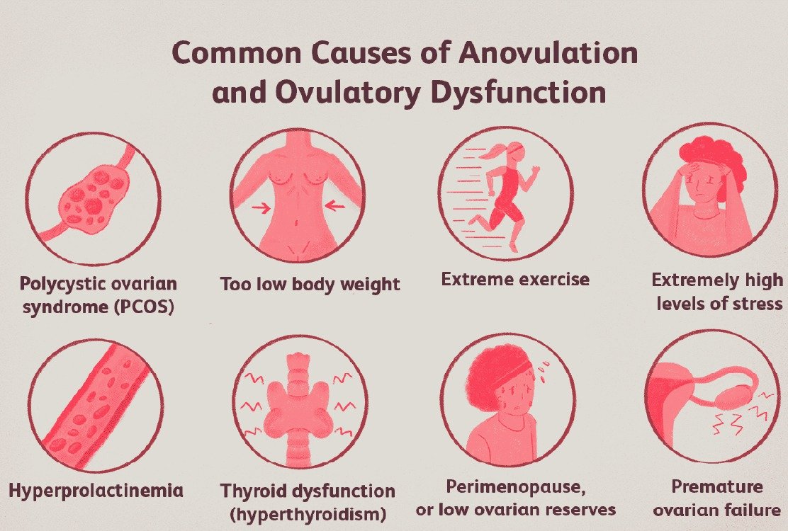 ovulatory_dysfunction_before_iui_in_turkey