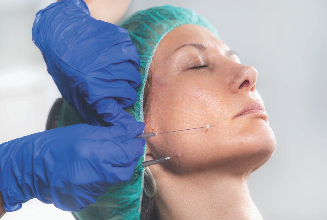 pdo_thread_lift_in_turkey_woman