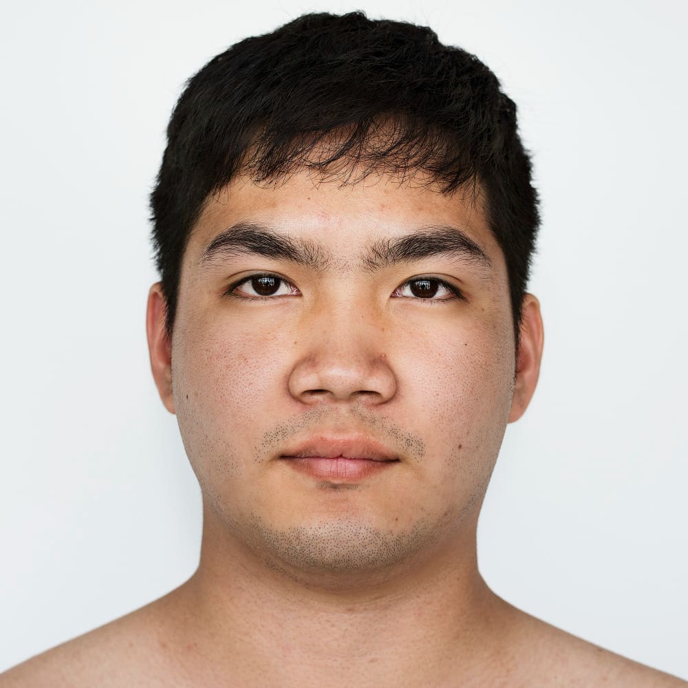 /upload/galeri/portrait_of_asian_man_with_ethnic_nose_for_ethnic_rhinoplasty_in_turkey