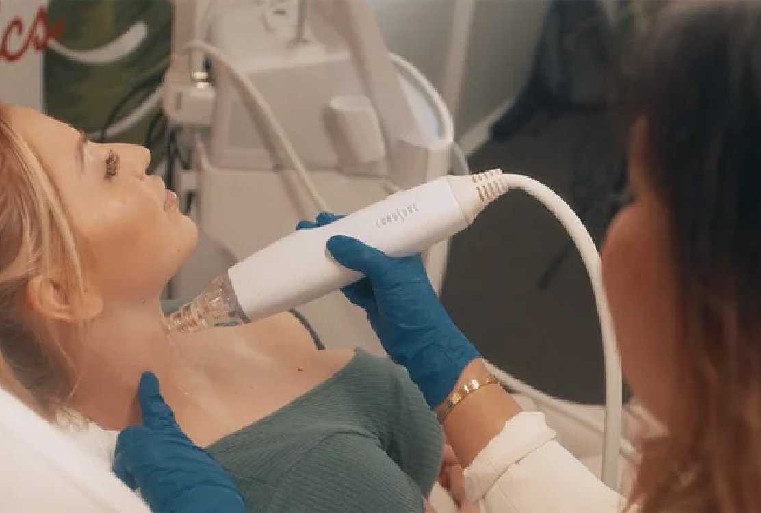 radiofrequency _for _decolletage _rejuvenation_ in _Turkey