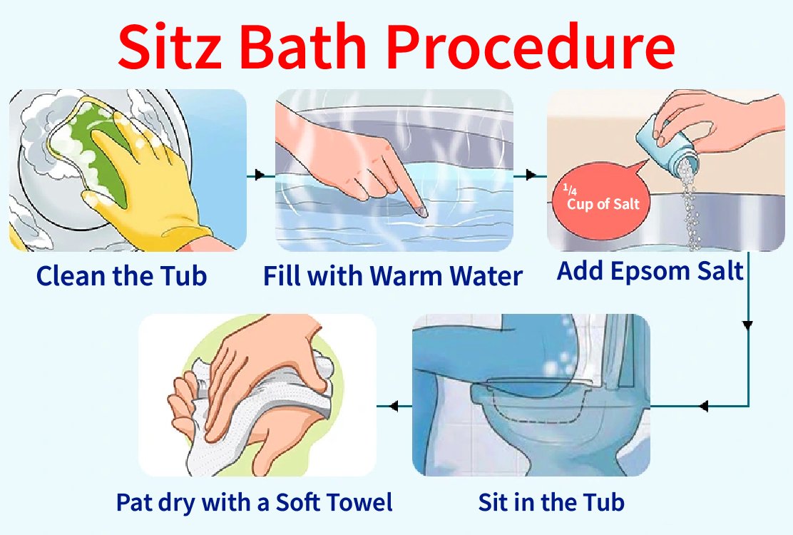sitz_bath_for_Anal_Fistula_Surgery_in_Turkey