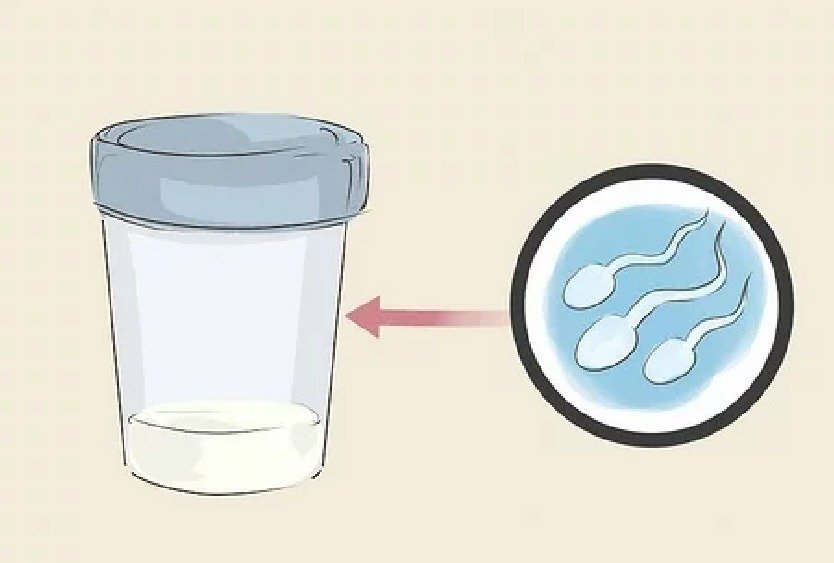 sperm_collection_for_icsi_in_turkey