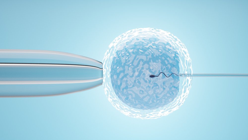 sperm_deposited_in_ovum_with_iui_in_turkey