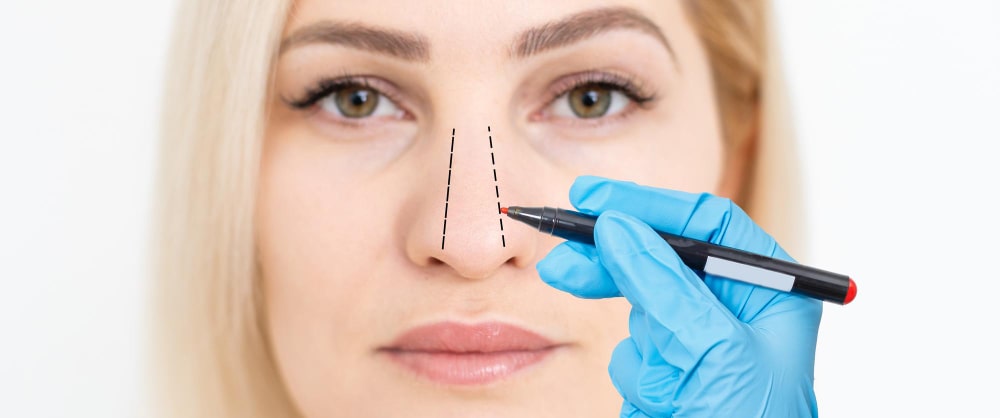 /upload/galeri/surgeon_marks_womans_nose_for_ethnic_rhinoplasty_surgery_in_turkey