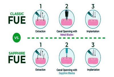 vector_illustrating_DHI_vs_FUE