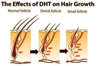 vector_illustrating_how_DHT_works