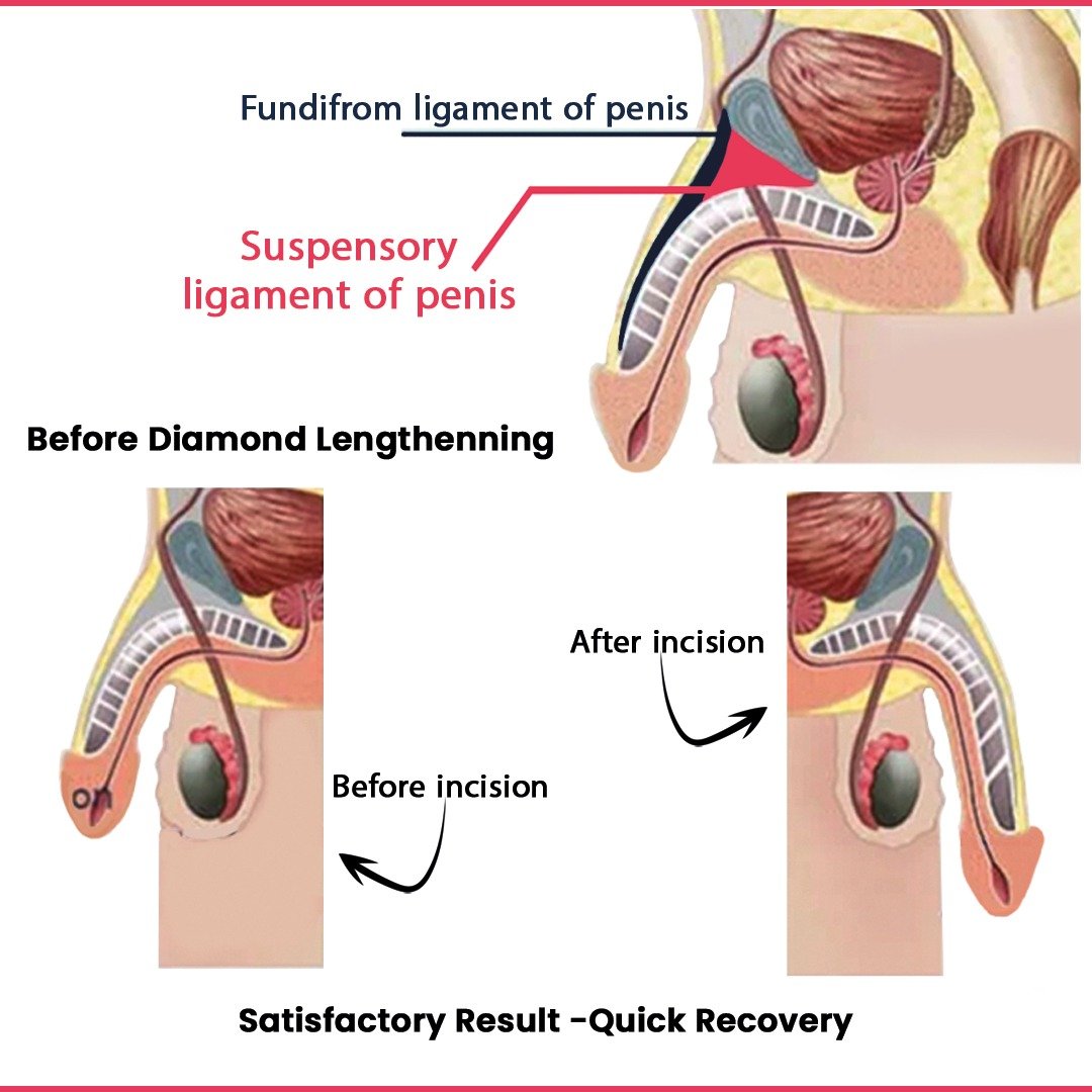 vector_showing_suspension_ligament