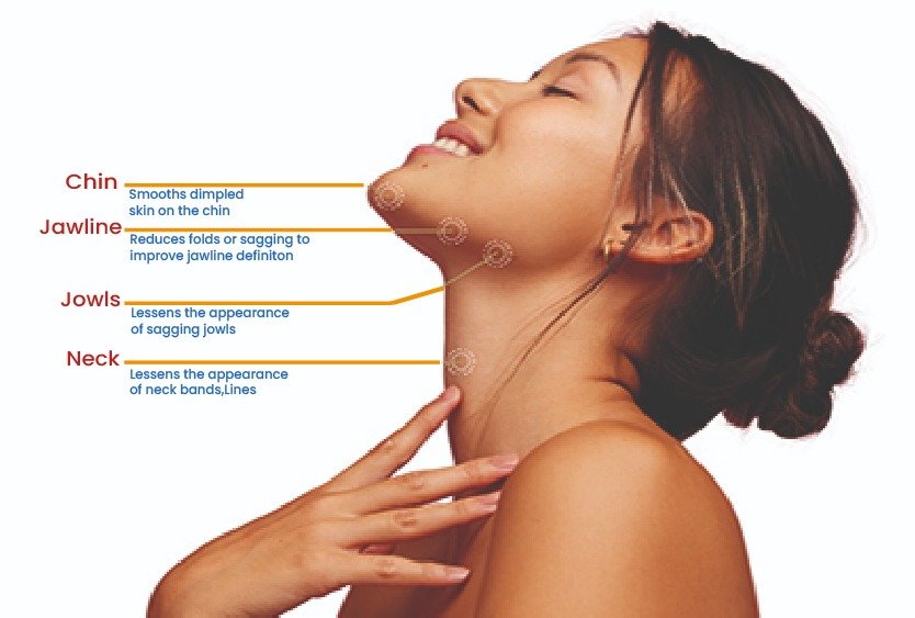 visual_explanation_of_nefertiti_neck_lift_in_turkey