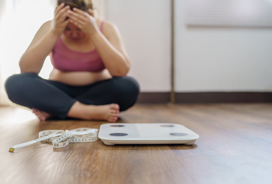 woman_ still_ fat _before_ gastric _sleeve _revision _in_ turkey