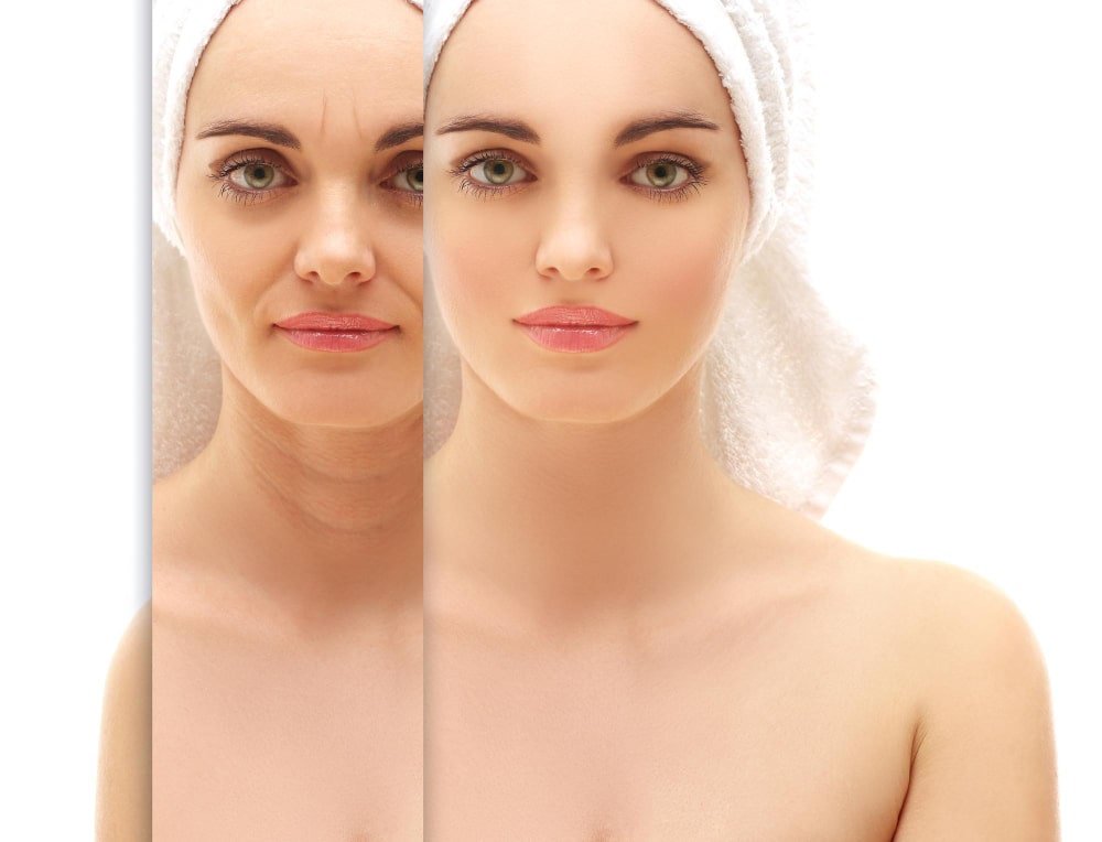 woman_before_and_after_treatment