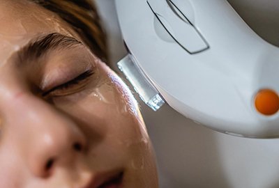 woman_getting_laser_eyebag_treatment