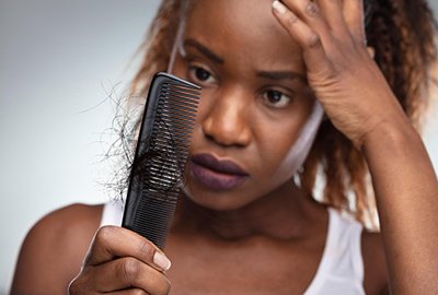 woman_noticing_hairloss_before_afro_hair_transplant_in_turkey (2)