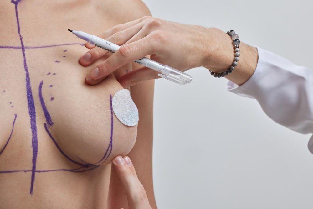 woman_with_breast_implant_guideline_for_breast_augmentation_in_turkey