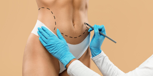 woman_with_contours_thanks_to_lipo