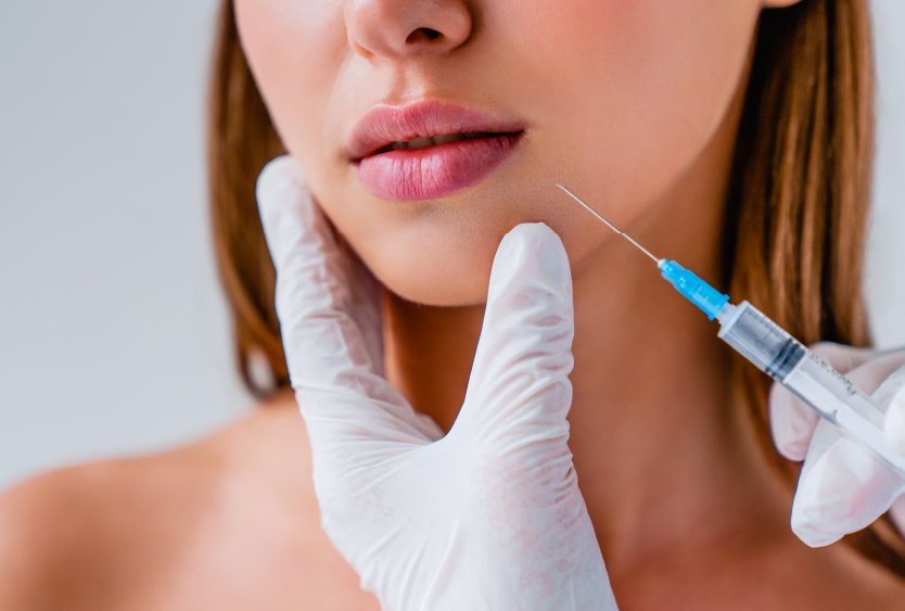 woman_with_non_surgical_chin_implant_in_turkey