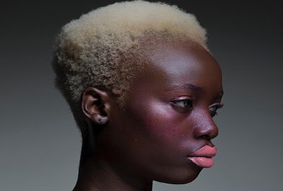 woman_with_receding_hairline_before_afro_hair_transplant_in_turkey