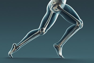 xray_of_leg_for_limb_lengthening_surgery_in_turkey